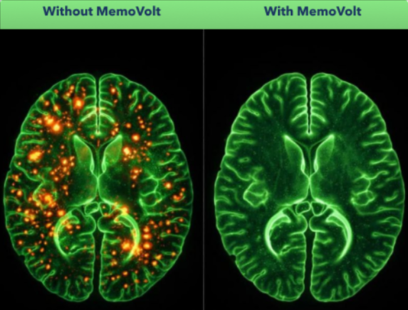 Memovolt Benefits